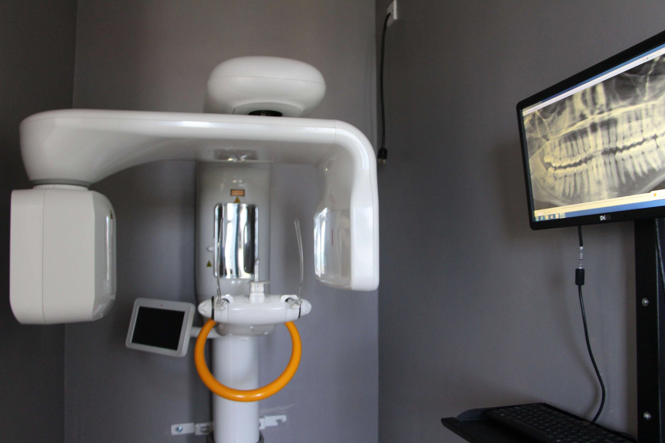 The digital panoramic X-ray suite at Elite Smiles